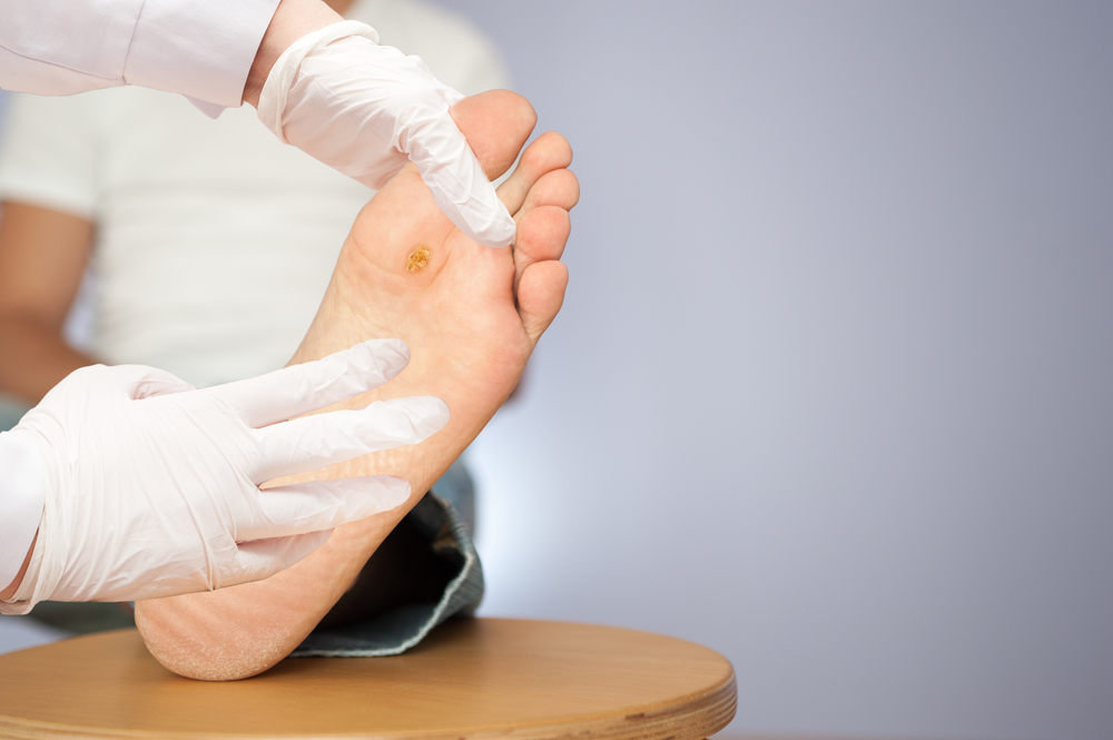 Advanced Foot Treatments: Solutions for Common Foot Problems