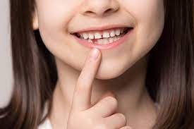 black spot on teeth causes removal and prevention dentists guide